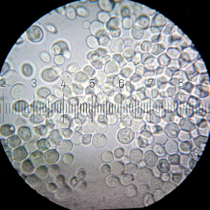 drożdże pod mikroskopem